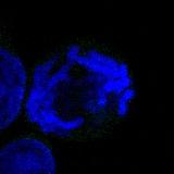 Mitosis Photo 